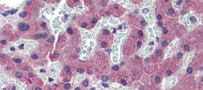 TFR2 Antibody in Immunohistochemistry (IHC)