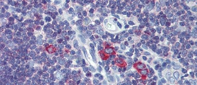 TFR2 Antibody in Immunohistochemistry (IHC)