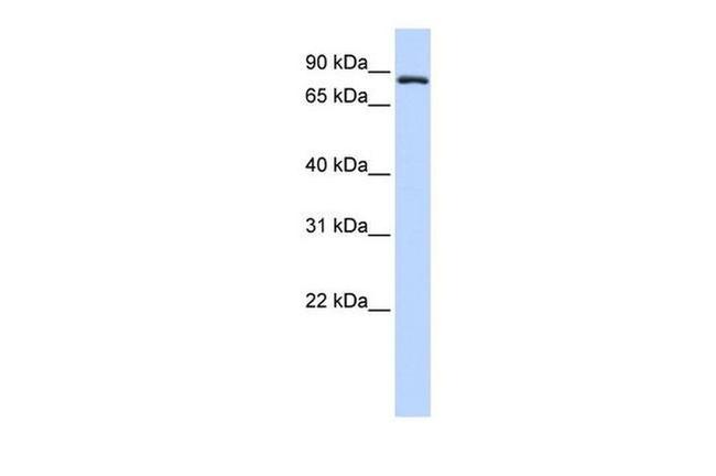 TFR2 Antibody in Western Blot (WB)