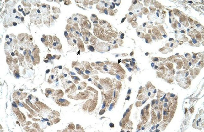 CHST1 Antibody in Immunohistochemistry (IHC)