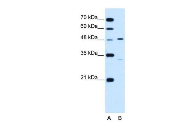 CHST1 Antibody in Western Blot (WB)