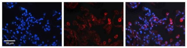 DEGS1 Antibody in Immunohistochemistry (Paraffin) (IHC (P))