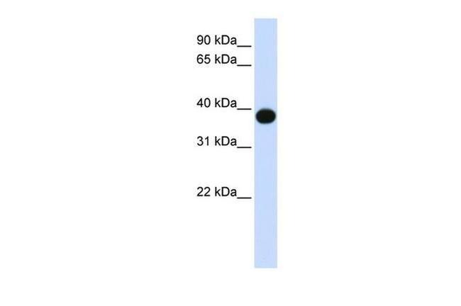 DEGS1 Antibody in Western Blot (WB)