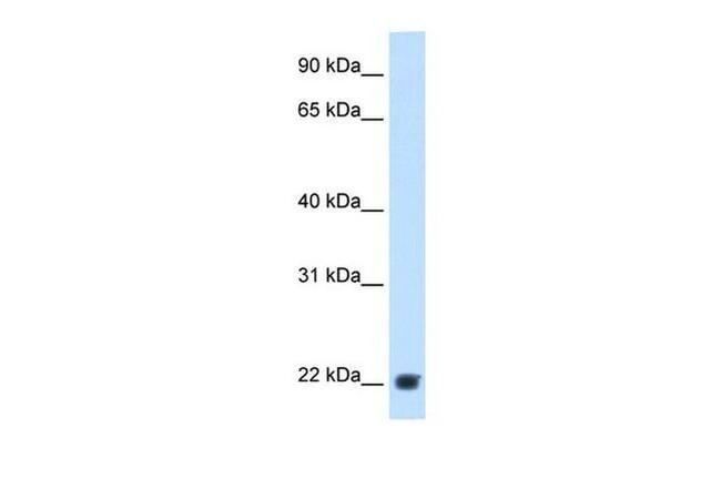 Plasma Kallikrein Antibody in Western Blot (WB)