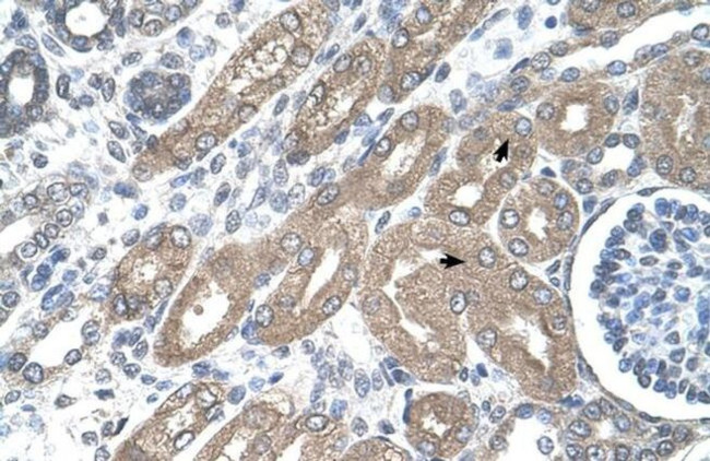 TDO2 Antibody in Immunohistochemistry (Paraffin) (IHC (P))