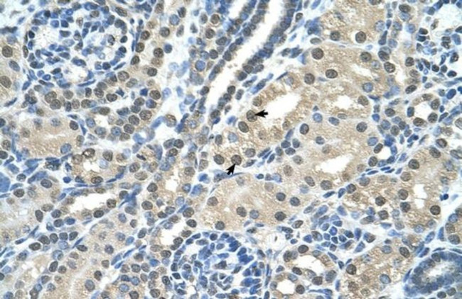 SBDS Antibody in Immunohistochemistry (IHC)