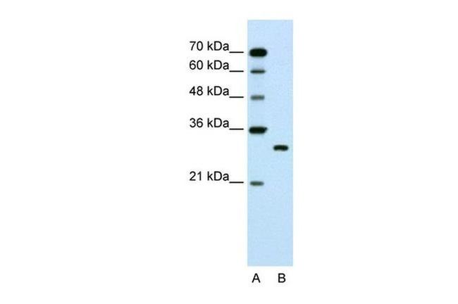 SBDS Antibody in Western Blot (WB)