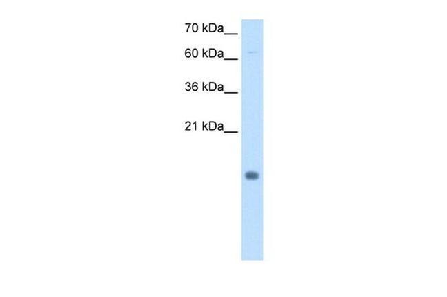 Cystatin B Antibody in Western Blot (WB)