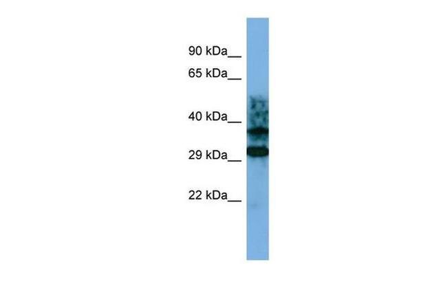 CRYZL1 Antibody in Western Blot (WB)