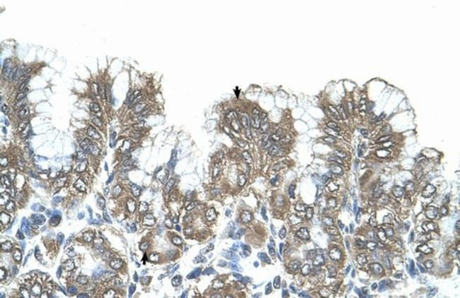 SIK1 Antibody in Immunohistochemistry (IHC)