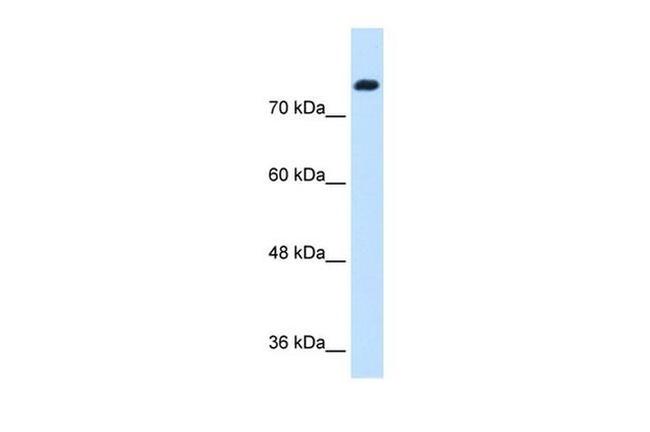 SIK1 Antibody in Western Blot (WB)