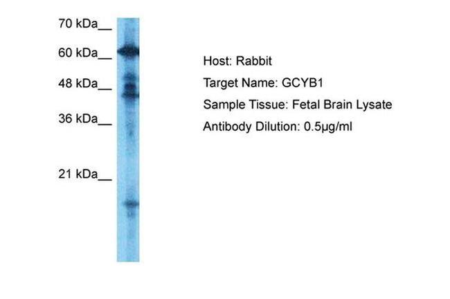 GUCY1B3 Antibody in Western Blot (WB)