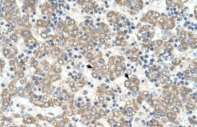 KYNU Antibody in Immunohistochemistry (IHC)