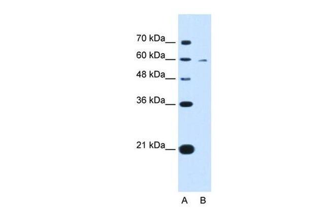 KYNU Antibody in Western Blot (WB)