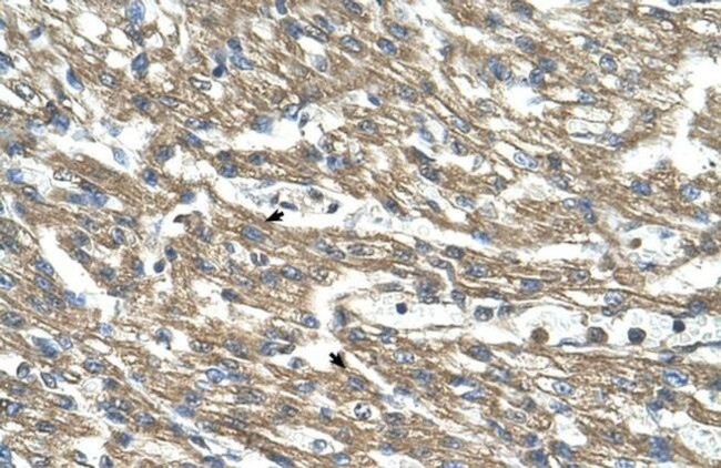 CTH Antibody in Immunohistochemistry (IHC)