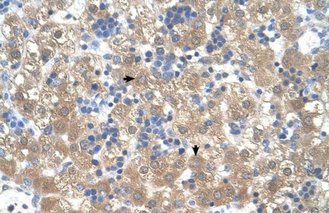 PEX3 Antibody in Immunohistochemistry (IHC)