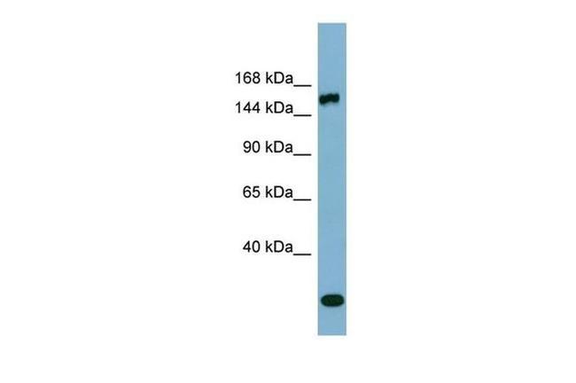 EPRS Antibody in Western Blot (WB)