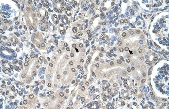 SHMT2 Antibody in Immunohistochemistry (Paraffin) (IHC (P))