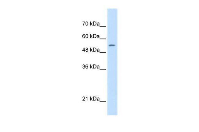 SHMT2 Antibody in Western Blot (WB)