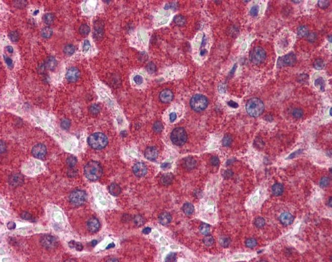 MTHFD1 Antibody in Immunohistochemistry (IHC)