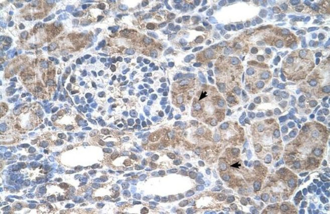 IFI44L Antibody in Immunohistochemistry (IHC)