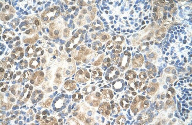 RFC5 Antibody in Immunohistochemistry (IHC)