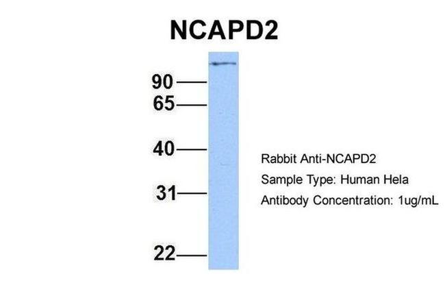 NCAPD2 Antibody in Western Blot (WB)