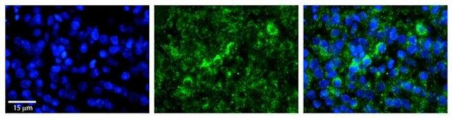 WBP11 Antibody in Immunohistochemistry (Paraffin) (IHC (P))