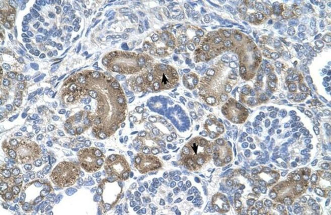 XTP3TPA Antibody in Immunohistochemistry (IHC)