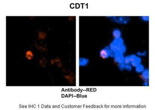 CDT1 Antibody in Immunohistochemistry (IHC)