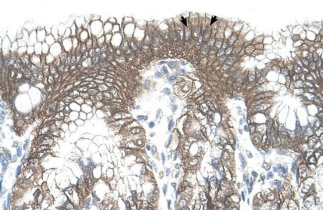 TARS Antibody in Immunohistochemistry (IHC)