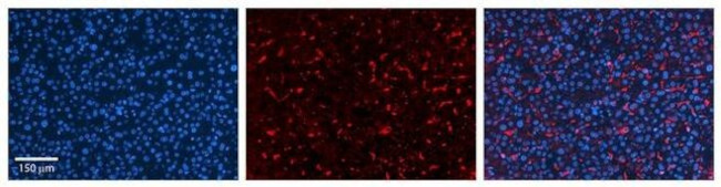 GPAA1 Antibody in Immunohistochemistry (Paraffin) (IHC (P))