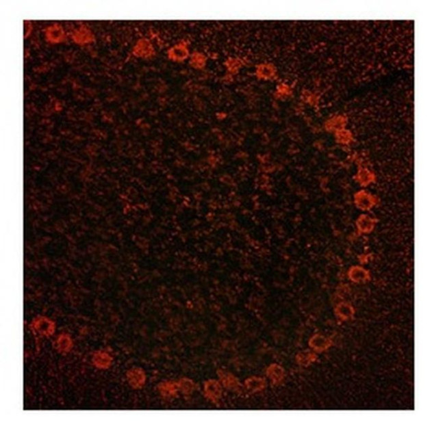 ADAM15 Antibody in Immunohistochemistry (IHC)