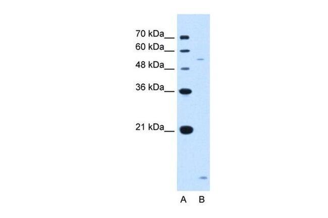 ST3GAL5 Antibody in Western Blot (WB)