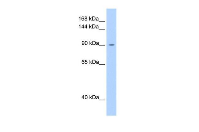 OSMR Antibody in Western Blot (WB)