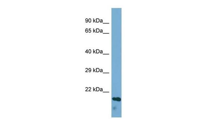 ECM1 Antibody in Western Blot (WB)