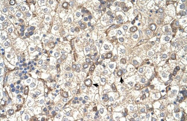 ST3GAL4 Antibody in Immunohistochemistry (IHC)