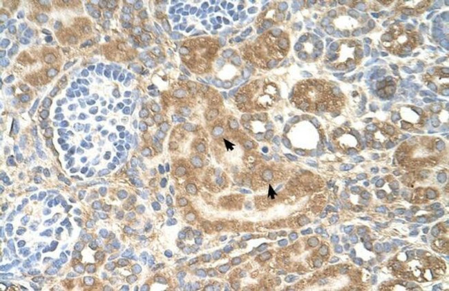 SPTLC1 Antibody in Immunohistochemistry (IHC)