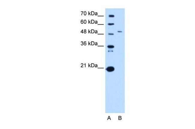 SPTLC1 Antibody in Western Blot (WB)