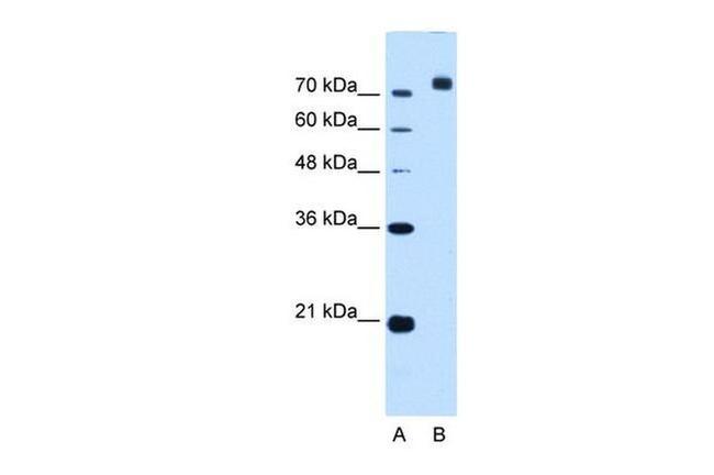 CORIN Antibody in Western Blot (WB)