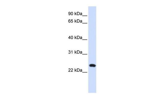 LAMP5 Antibody in Western Blot (WB)