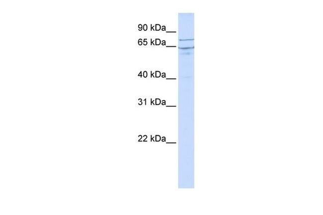 EDEM1 Antibody in Western Blot (WB)