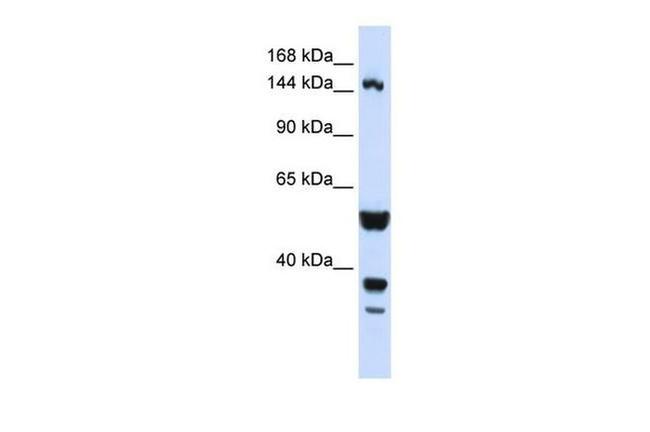 ABI3BP Antibody in Western Blot (WB)