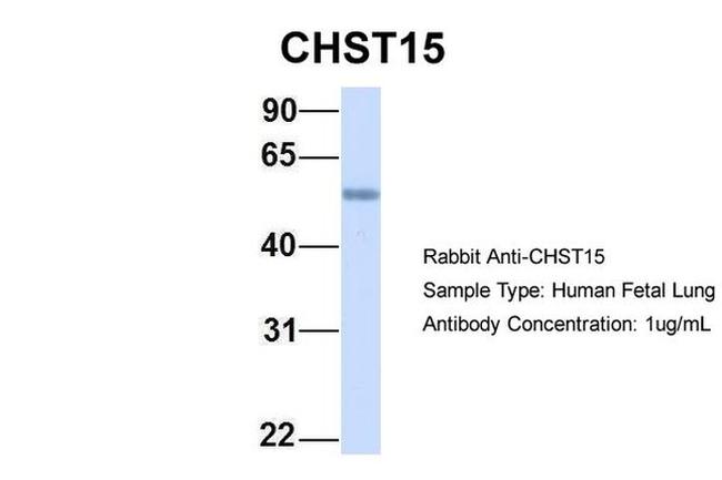 CHST15 Antibody in Western Blot (WB)