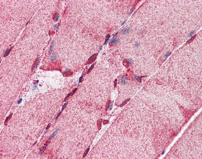 ACSL5 Antibody in Immunohistochemistry (IHC)