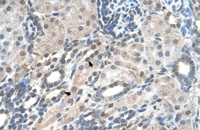 PIGV Antibody in Immunohistochemistry (IHC)