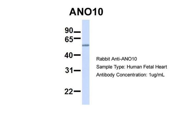 TMEM16K Antibody in Western Blot (WB)