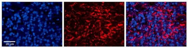 LAPTM4B Antibody in Immunohistochemistry (Paraffin) (IHC (P))