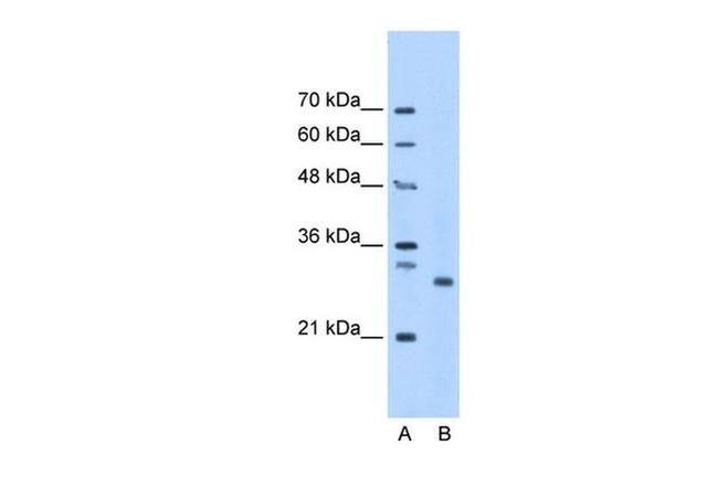 PSMC3IP Antibody in Western Blot (WB)