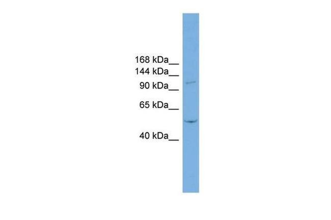 TNNI3K Antibody in Western Blot (WB)